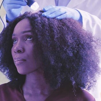 Decoding the Science: How Hair Supplements Work on Your Scalp