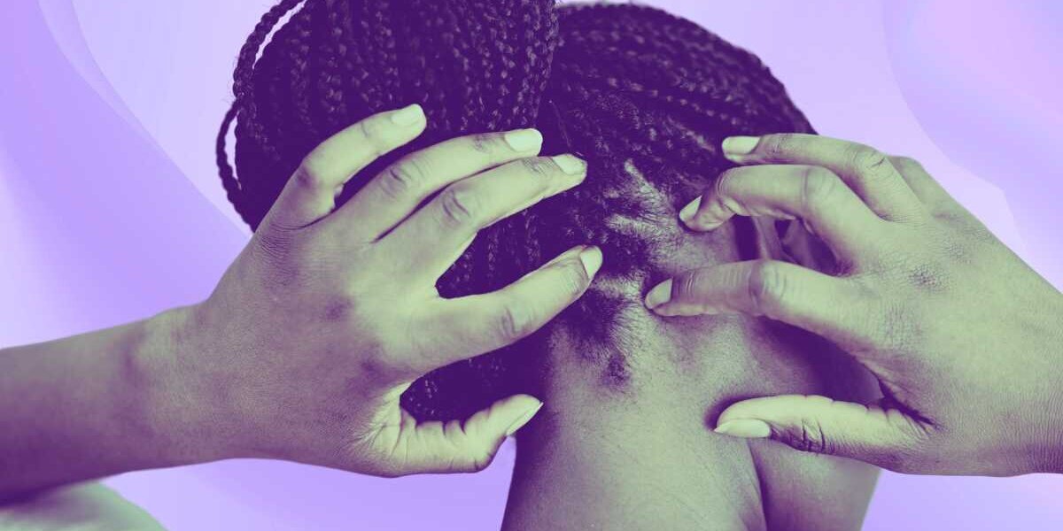 The Importance of Scalp Care for Kinky and Curly Hair